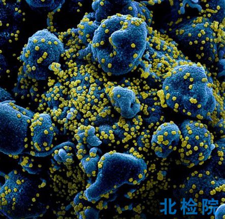 懸浮細胞病毒檢測